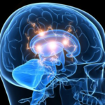 Brain Injury
