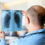 Pulmonary Embolism from Car Accidents